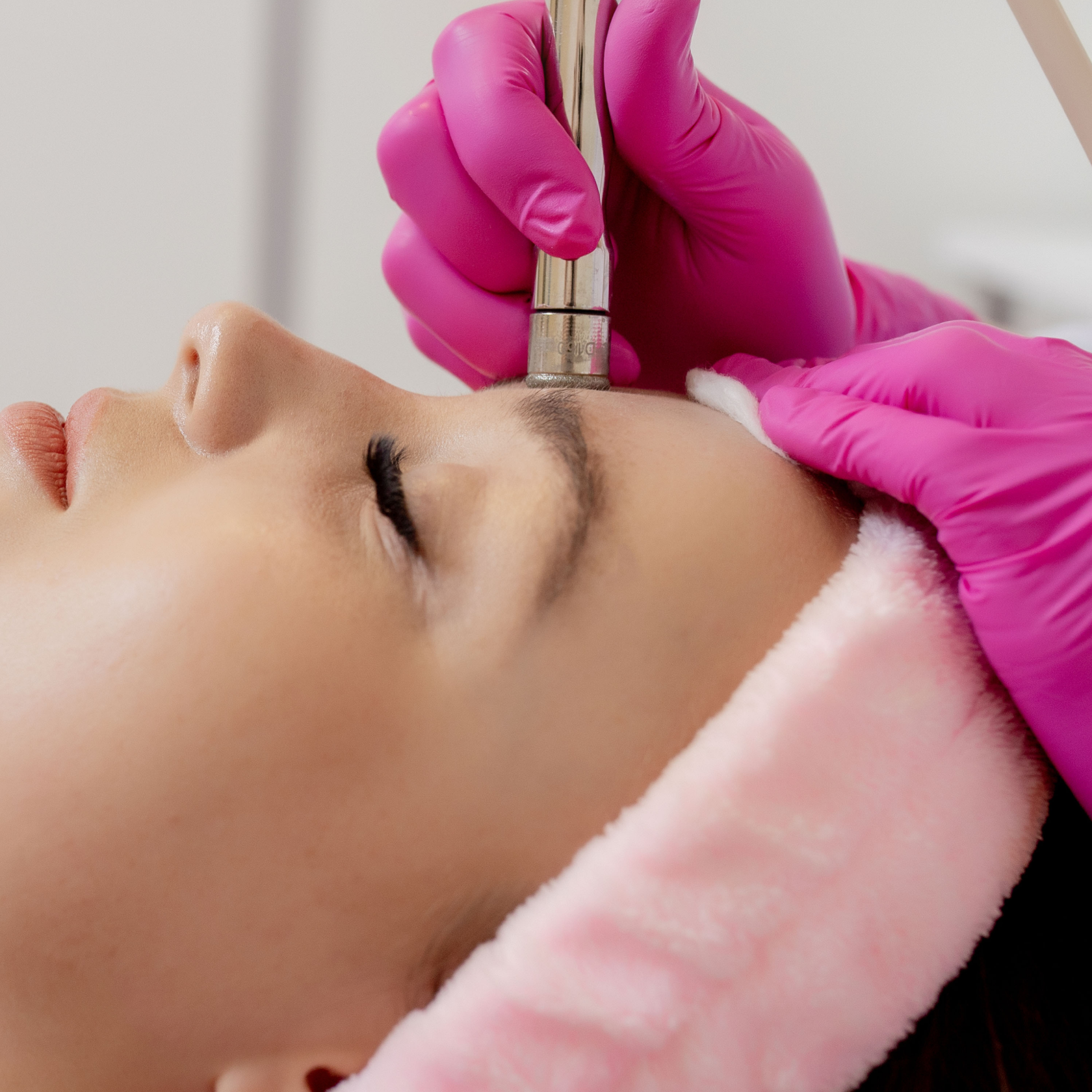 Microdermabrasion