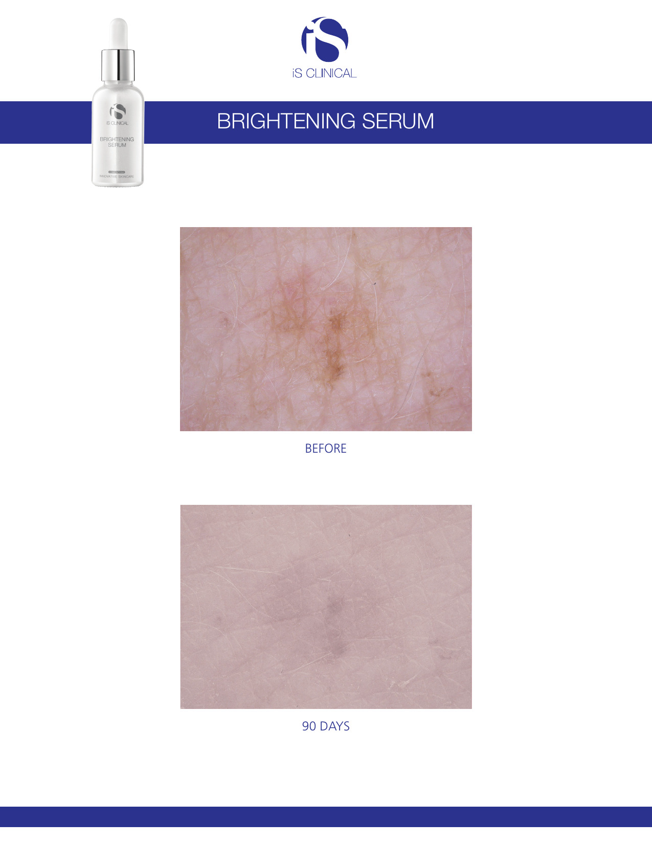 Sérum Brightening